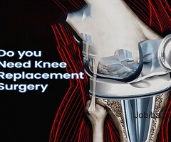 Knee Pain Treatment | Knee Replacement Surgeon In Ahmedabad