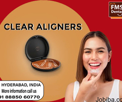 Embrace Your Journey: FMS SmartAlign Clear Aligners for a Radiant Smile